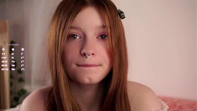 scarlet_fever10