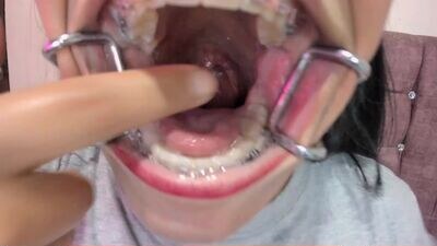 veky_saliva01